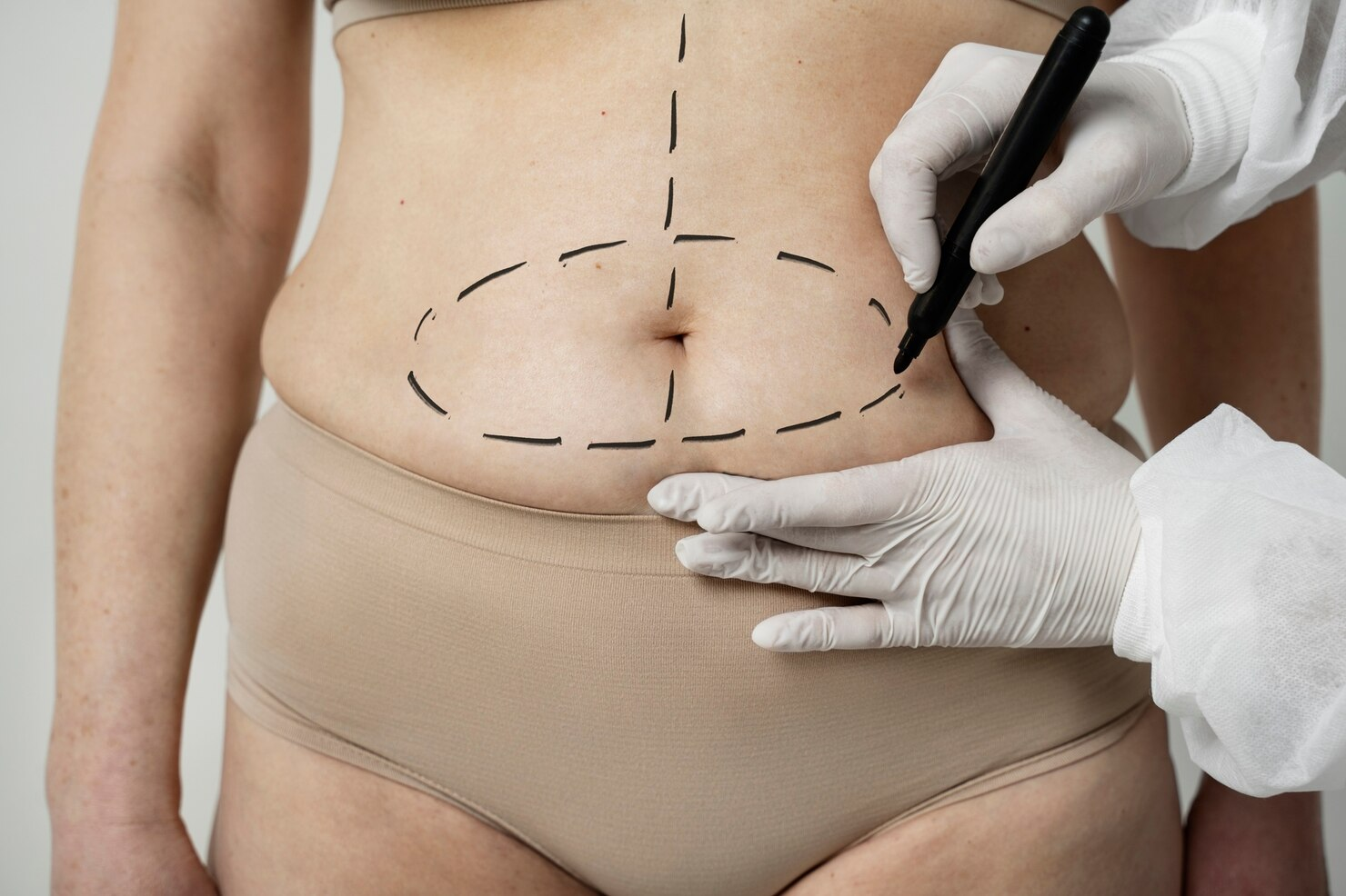 mujer-vista-frontal-rastros-marcador-vientre_23-2149349968